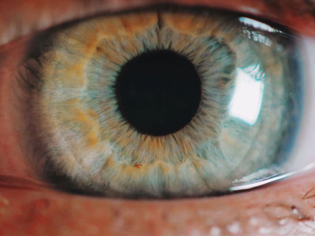 Rétinophotographe
