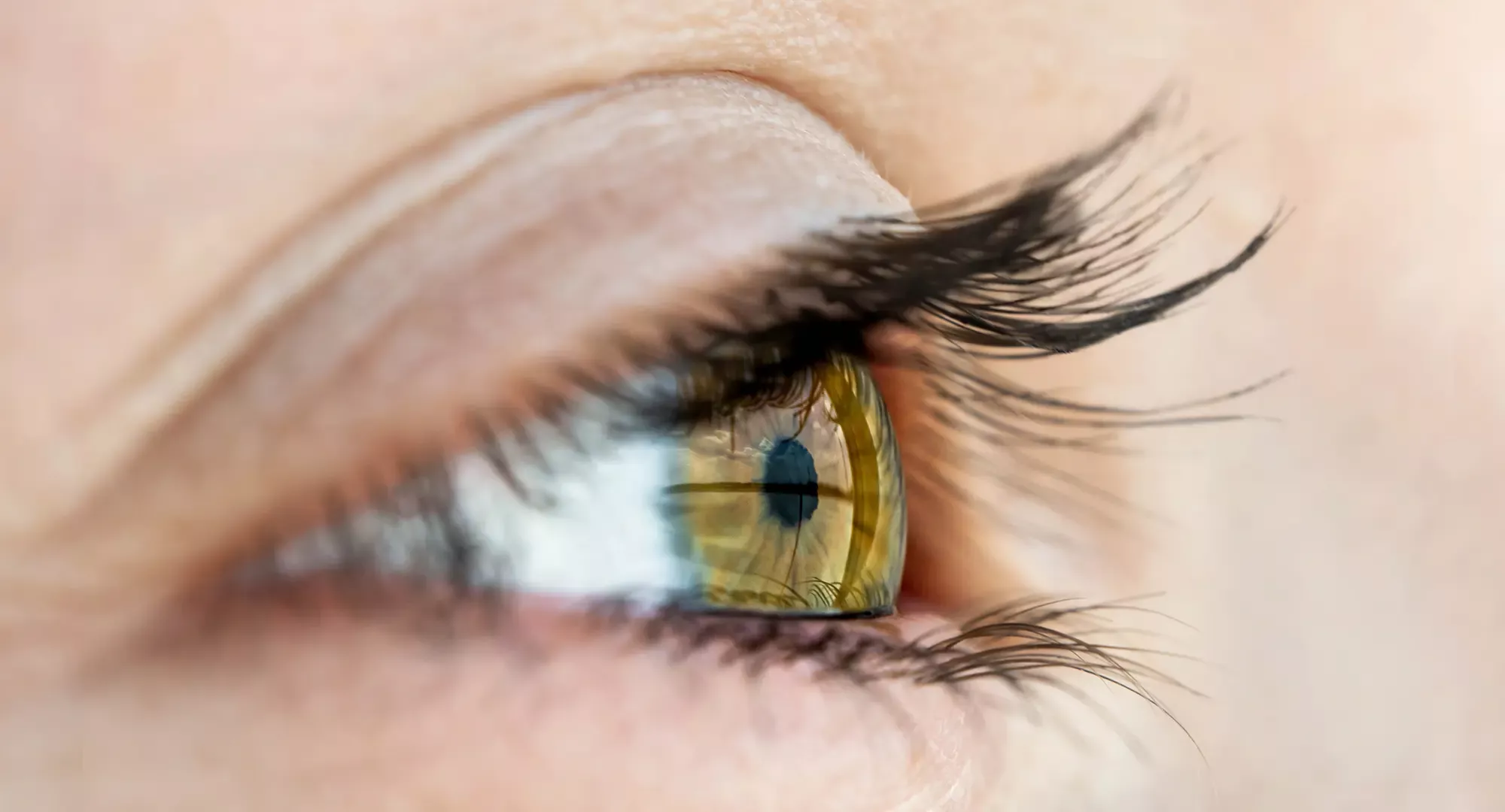 La cornée, maladie de l'oeil à Evry et Paris